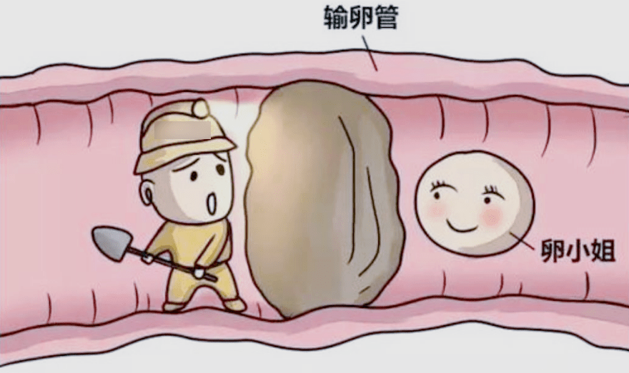 輸卵管上舉是怎麼回事，影響懷孕嗎？