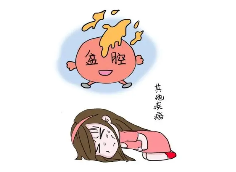 盆腔炎的主要病因是什麼